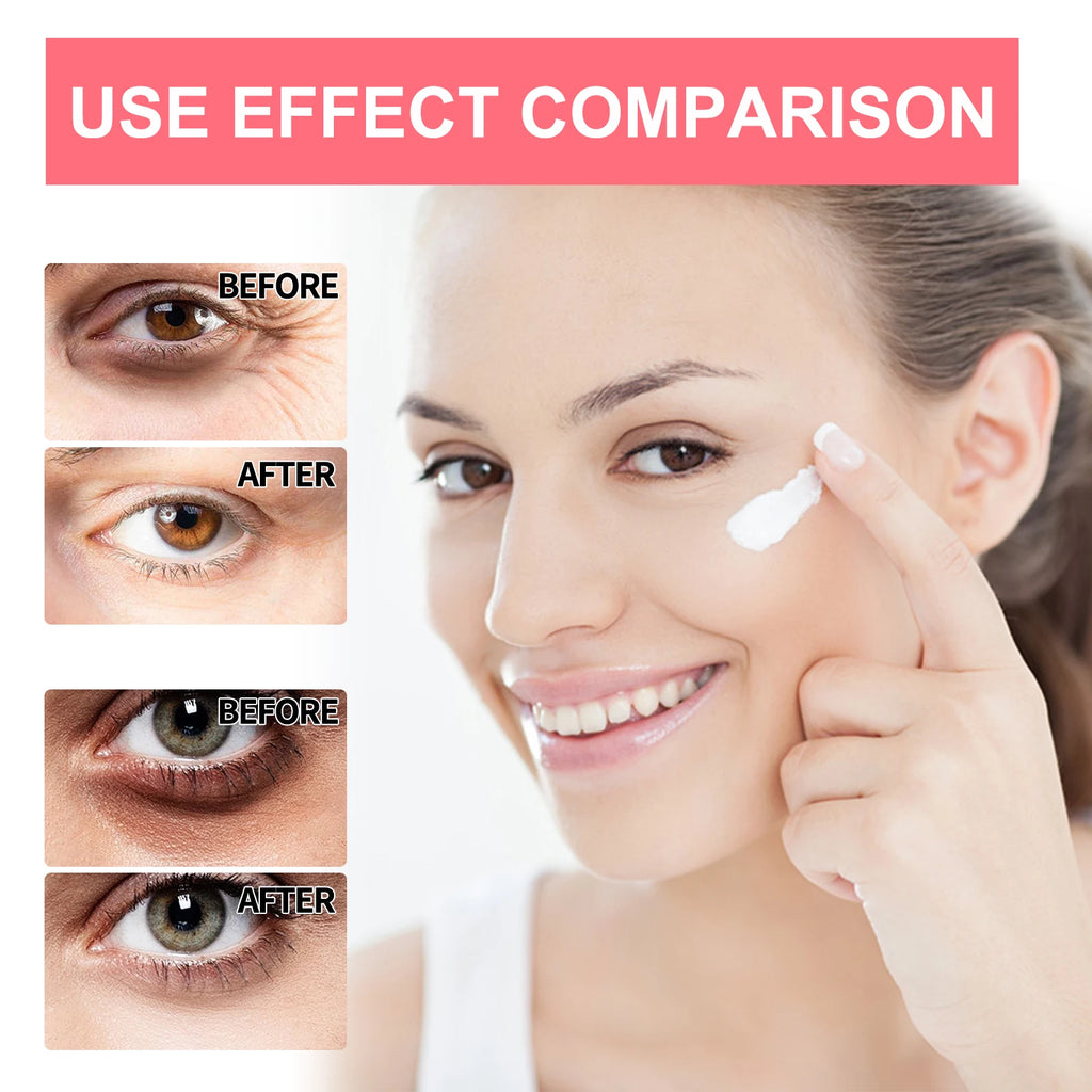 Retinol Under-Eye Cream Stick
